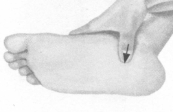 腰痛按摩部位图解