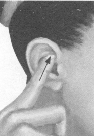 肩周炎按摩部位图解