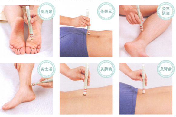 老年痴呆症艾灸哪个部位图解