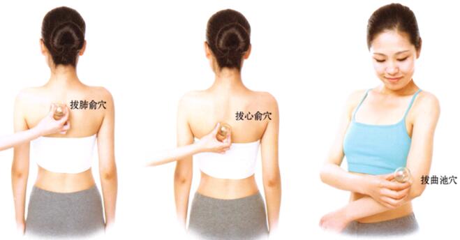 高脂血症刮痧部位图解