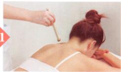 落枕艾灸哪个部位图解