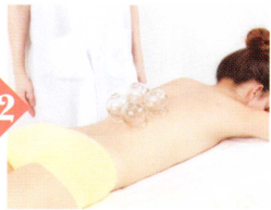 慢性胃炎拔罐部位图解