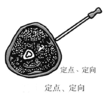 小针刀的进刀方法