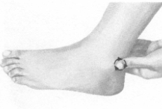 糖尿病按摩部位图解