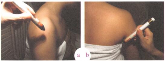 中风艾灸哪个部位图解