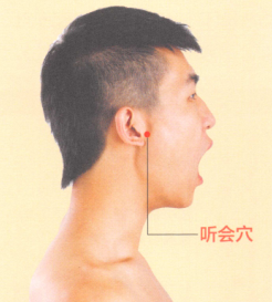 耳鸣-耳聋艾灸哪个部位图解