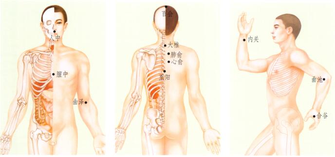 中暑刮痧部位图解