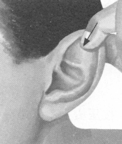 风湿病按摩部位图解