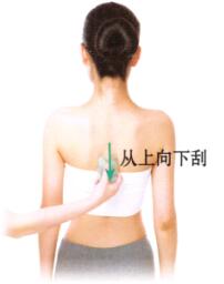 带状孢疹刮痧部位图解