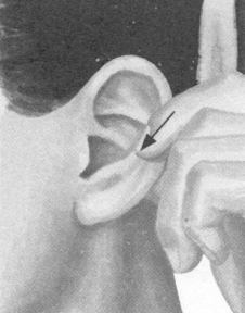 风湿病按摩部位图解