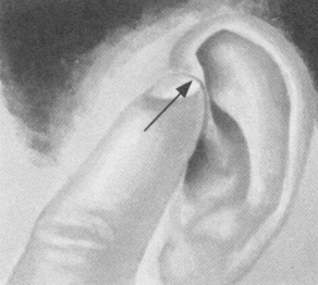 阳痿按摩部位图解