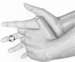 腰椎间盘突出症按摩部位图解