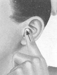 肥胖症按摩部位图解