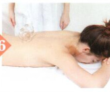 调经止带拔罐部位图解