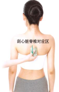 冠心病刮痧部位图解
