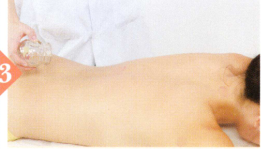 脱肛拔罐部位图解