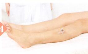 高血压拔罐部位图解