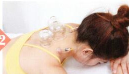 颈椎病拔罐部位图解