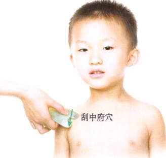 百日咳刮痧部位图解