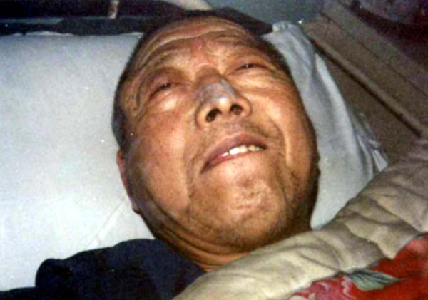 中医望色之面色红黄，目暗睛迷