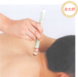 落枕艾灸哪个部位图解