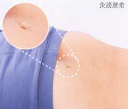 前列腺炎艾灸哪个部位图解