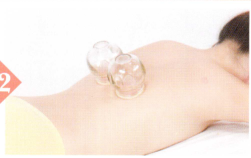 消化性溃疡拔罐部位图解