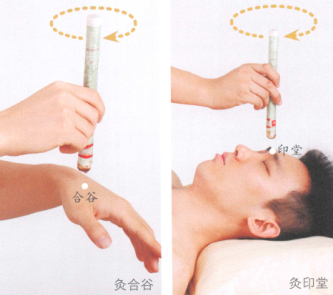 鼻窦炎艾灸哪个部位图解