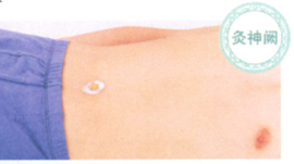 中风艾灸哪个部位图解