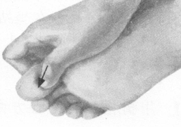 耳鸣-耳聋按摩部位图解