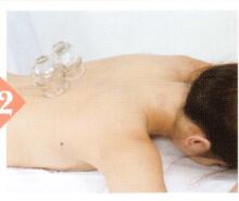 眩晕拔罐部位图解