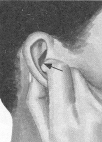 肥胖症按摩部位图解