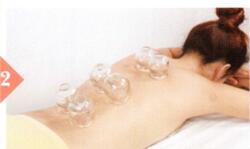 偏头痛拔罐部位图解