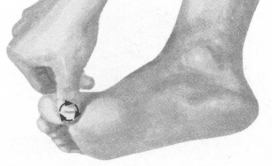 肩周炎按摩部位图解