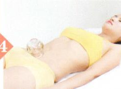 慢性盆腔炎拔罐部位图解