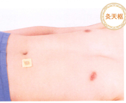 痢疾艾灸哪个部位图解