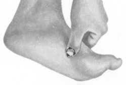 高脂血症按摩部位图解