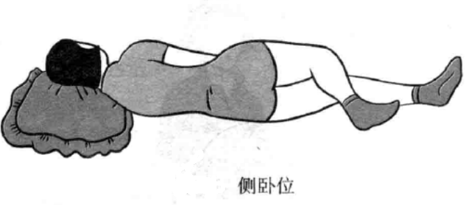 梅花针叩刺治疗时患者的体位