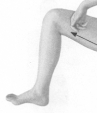 风湿病按摩部位图解