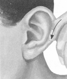 风湿病按摩部位图解