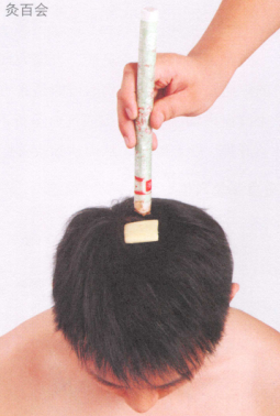 脱肛艾灸哪个部位图解