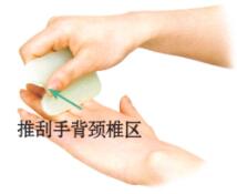 颈椎病刮痧部位图解