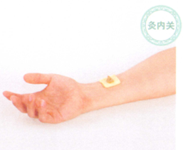 心律失常艾灸哪个部位图解