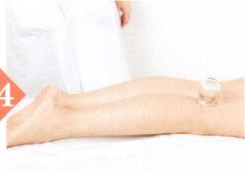 疔疮拔罐部位图解