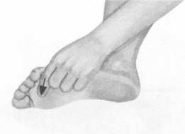 肩周炎按摩部位图解