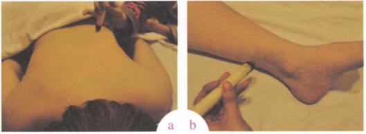 白带病艾灸哪个部位图解