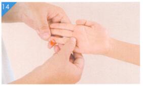 小儿积滞按摩部位图解