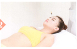 面神经麻痹拔罐部位图解