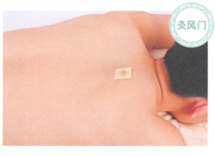 哮喘艾灸哪个部位图解