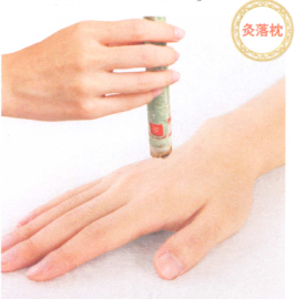 落枕艾灸哪个部位图解